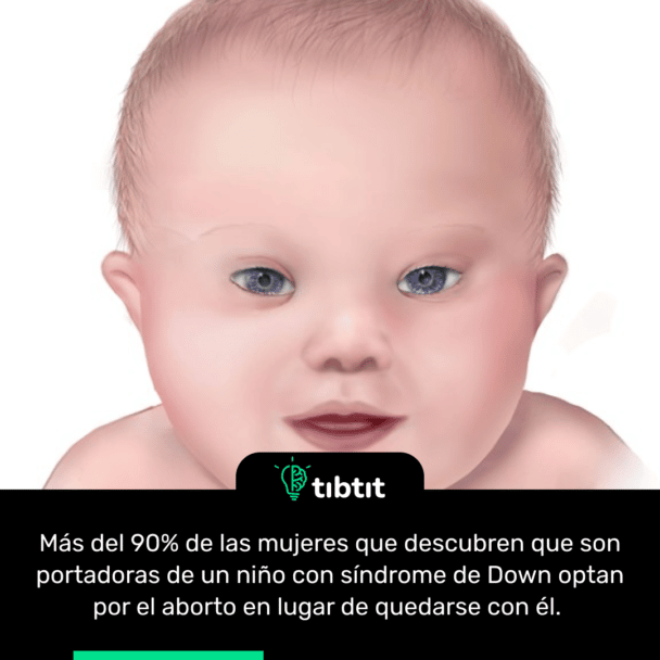 Más del 90% de las mujeres que descubren que son portadoras de un niño con síndrome de Down optan por el aborto en lugar de quedarse con él.