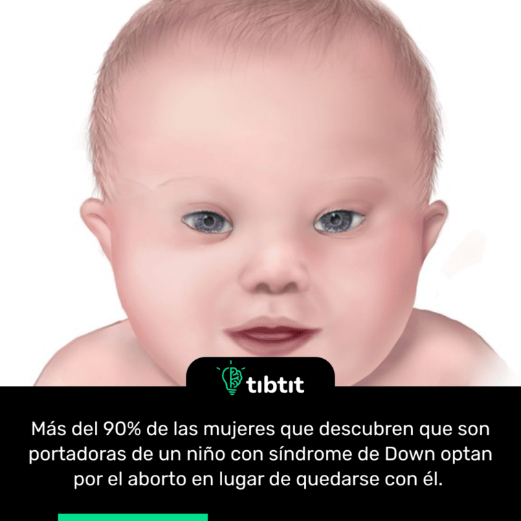 Más del 90% de las mujeres que descubren que son portadoras de un niño con síndrome de Down optan por el aborto en lugar de quedarse con él.