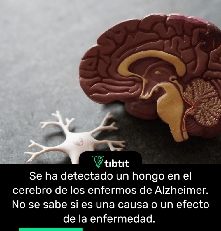 Se ha detectado un hongo en el cerebro de los enfermos de Alzheimer. No se sabe si es una causa o un efecto de la enfermedad.