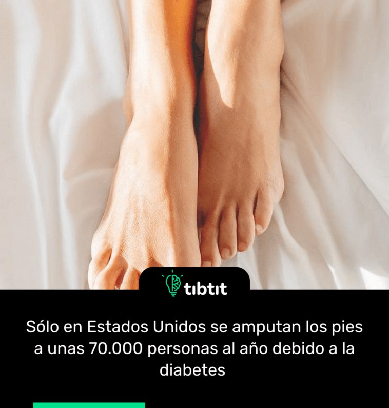 Sólo en Estados Unidos se amputan los pies a unas 70.000 personas al año debido a la diabetes