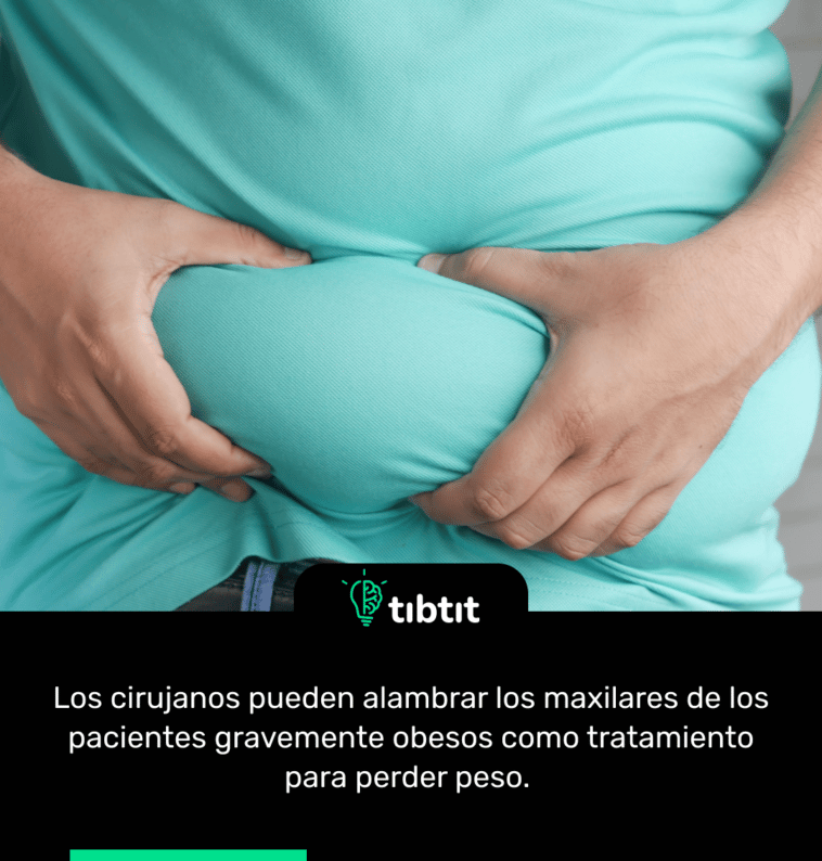 Los cirujanos pueden alambrar los maxilares de los pacientes gravemente obesos como tratamiento para perder peso.