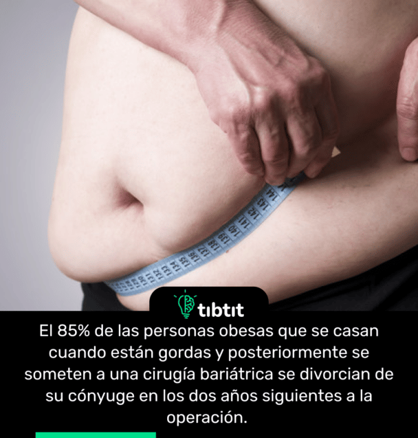 El 85% de las personas obesas que se casan cuando están gordas y posteriormente se someten a una cirugía bariátrica se divorcian de su cónyuge en los dos años siguientes a la operación.