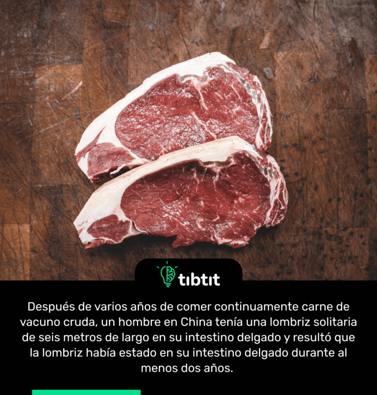 Después de varios años de comer continuamente carne de vacuno cruda, un hombre en China tenía una lombriz solitaria de seis metros de largo en su intestino delgado y resultó que la lombriz había estado en su intestino delgado durante al menos dos años.