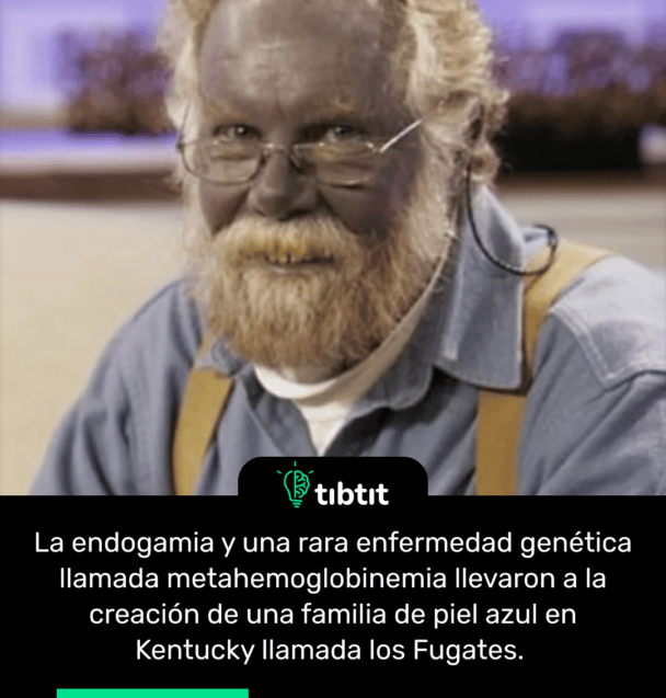 La endogamia y una rara enfermedad genética llamada metahemoglobinemia llevaron a la creación de una familia de piel azul en Kentucky llamada los Fugates.