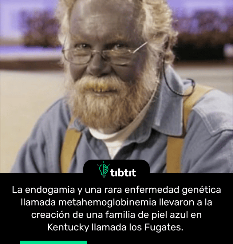 La endogamia y una rara enfermedad genética llamada metahemoglobinemia llevaron a la creación de una familia de piel azul en Kentucky llamada los Fugates.