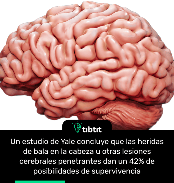 Un estudio de Yale concluye que las heridas de bala en la cabeza u otras lesiones cerebrales penetrantes dan un 42% de posibilidades de supervivencia