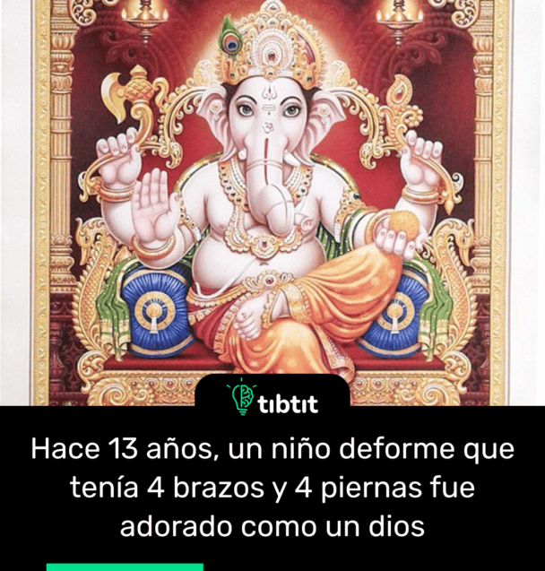 Hace 13 años, un niño deforme que tenía 4 brazos y 4 piernas fue adorado como un dios