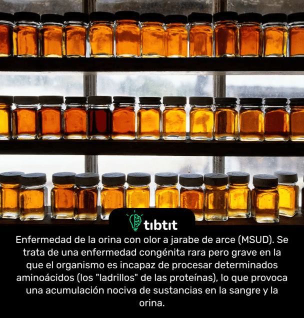 Enfermedad de la orina con olor a jarabe de arce (MSUD). Se trata de una enfermedad congénita rara pero grave en la que el organismo es incapaz de procesar determinados aminoácidos (los "ladrillos" de las proteínas), lo que provoca una acumulación nociva de sustancias en la sangre y la orina.