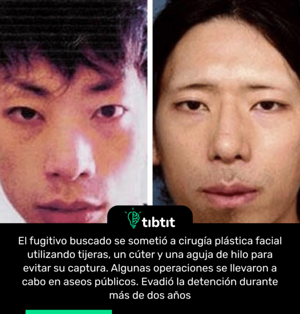 El fugitivo buscado se sometió a cirugía plástica facial utilizando tijeras, un cúter y una aguja de hilo para evitar su captura. Algunas operaciones se llevaron a cabo en aseos públicos. Evadió la detención durante más de dos años