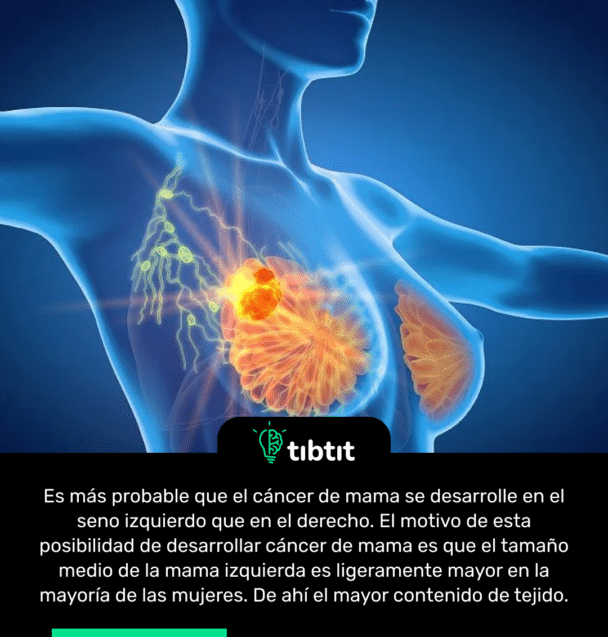 Es más probable que el cáncer de mama se desarrolle en el seno izquierdo que en el derecho. El motivo de esta posibilidad de desarrollar cáncer de mama es que el tamaño medio de la mama izquierda es ligeramente mayor en la mayoría de las mujeres. De ahí el mayor contenido de tejido.