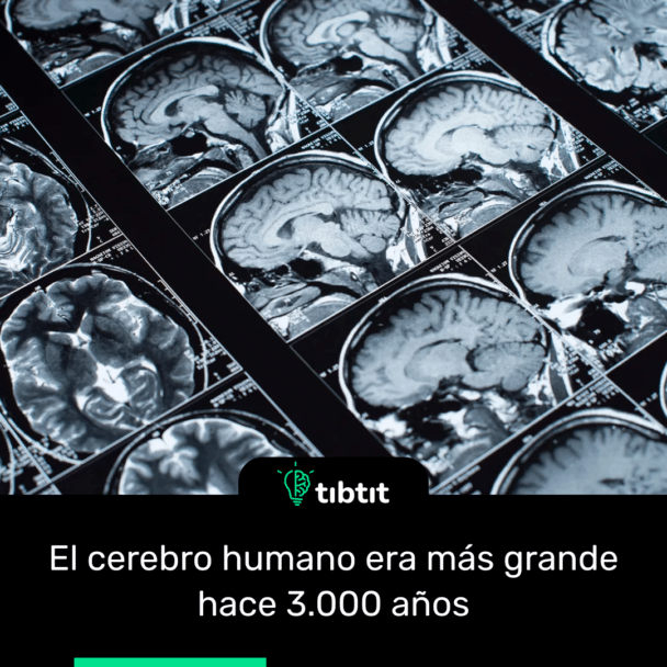 El cerebro humano era más grande hace 3.000 años