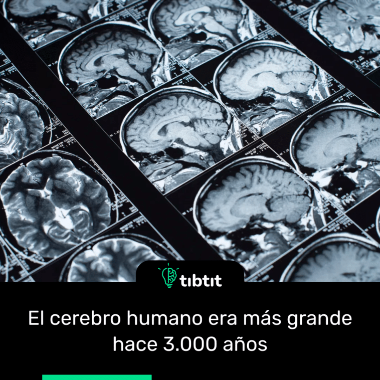 El cerebro humano era más grande hace 3.000 años