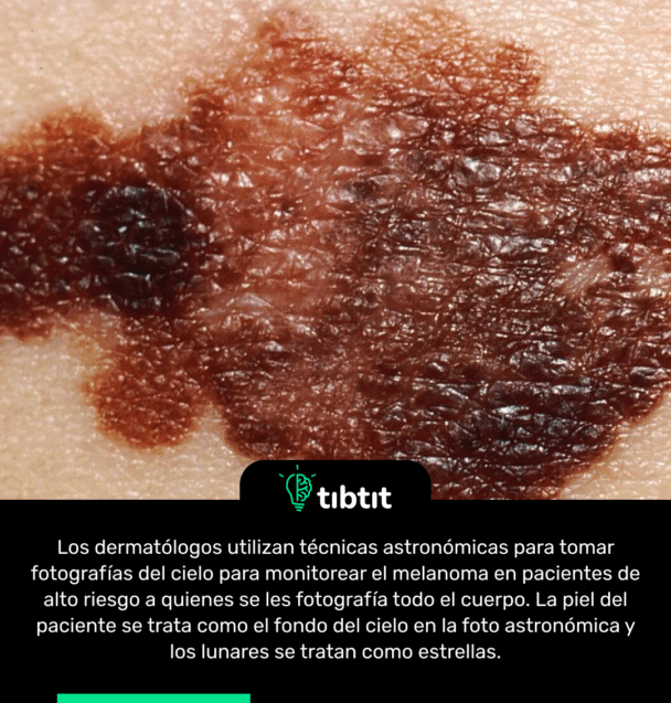Los dermatólogos utilizan técnicas astronómicas para tomar fotografías del cielo para monitorear el melanoma en pacientes de alto riesgo a quienes se les fotografía todo el cuerpo. La piel del paciente se trata como el fondo del cielo en la foto astronómica y los lunares se tratan como estrellas.