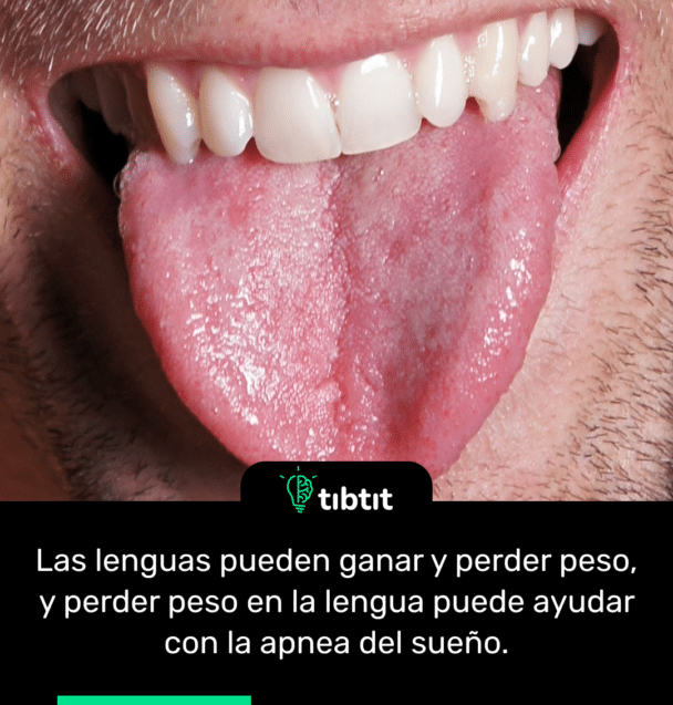 Las lenguas pueden ganar y perder peso, y perder peso en la lengua puede ayudar con la apnea del sueño.
