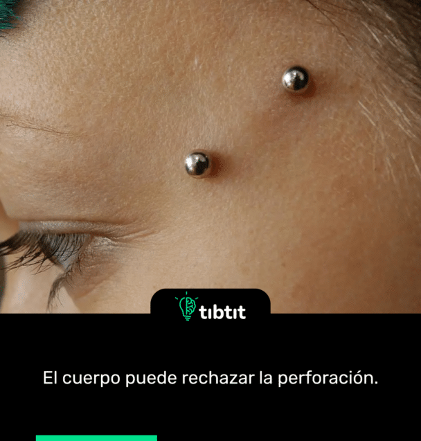 El cuerpo puede rechazar la perforación