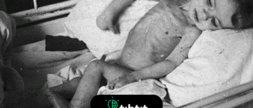 La hambruna en los Países Bajos en 1944 afectará a las generaciones venideras. Los hijos de mujeres embarazadas durante este tiempo tienen más probabilidades de desarrollar problemas de salud como diabetes. Además, sus bisnietos también tienen más probabilidades de sufrir problemas de salud.