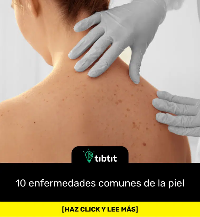 10 enfermedades comunes de la piel