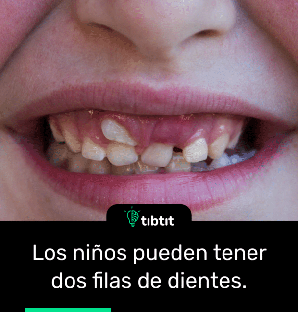Los niños pueden tener dos filas de dientes.