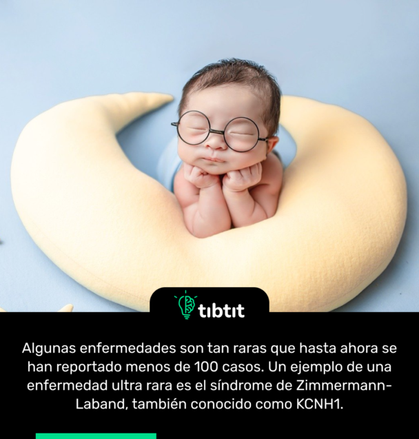 Algunas enfermedades son tan raras que hasta ahora se han reportado menos de 100 casos. Un ejemplo de una enfermedad ultra rara es el síndrome de Zimmermann-Laband, también conocido como KCNH1.