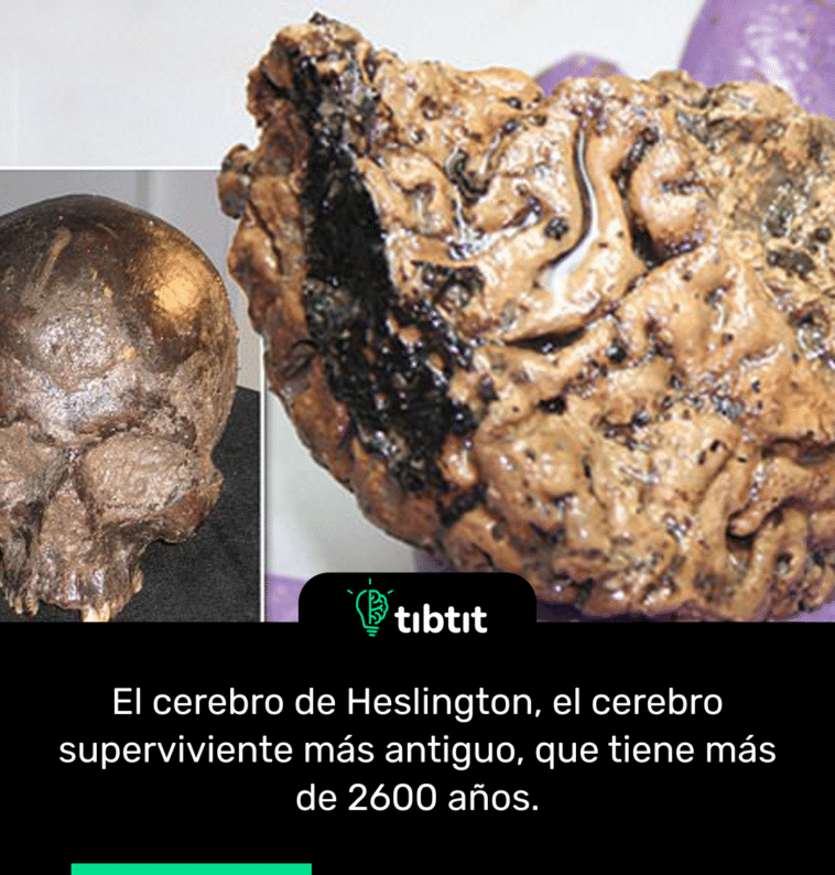 El cerebro de Heslington, el cerebro superviviente más antiguo, que tiene más de 2600 años.