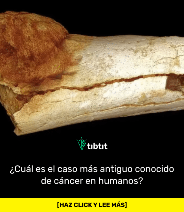 ¿Cuál es el caso más antiguo conocido de cáncer en humanos?