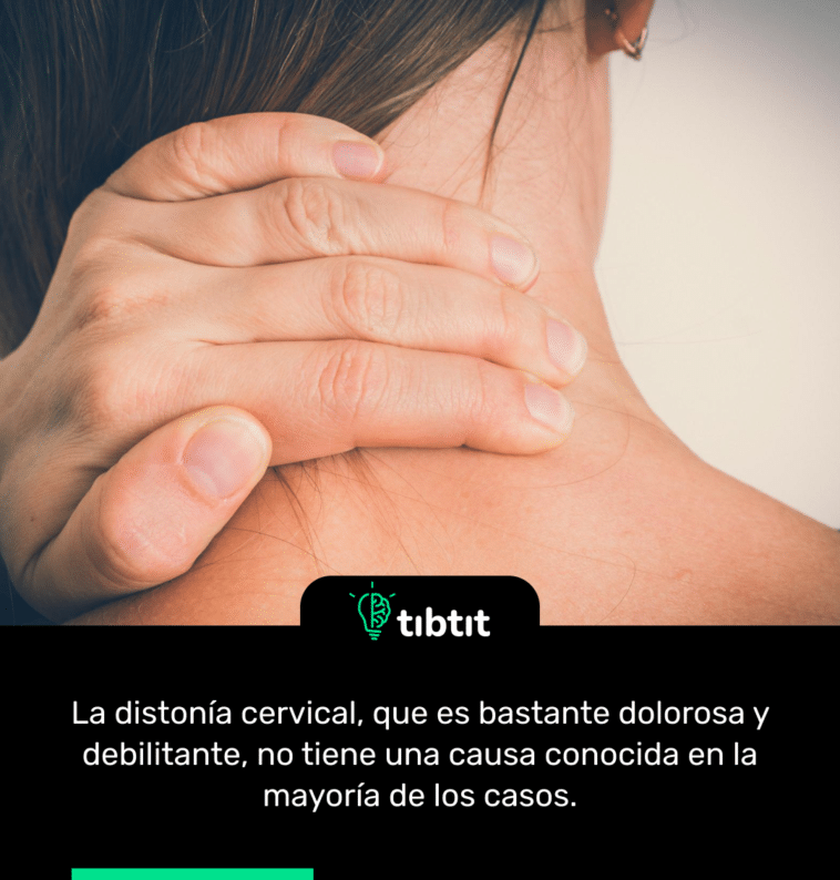 La distonía cervical, que es bastante dolorosa y debilitante, no tiene una causa conocida en la mayoría de los casos.