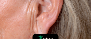 ¿Por qué nuestras orejas están todas arrugadas y con curvas?